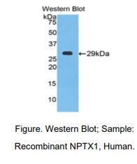 https://msimg.bioon.com/bionline/goods-no-pic.png