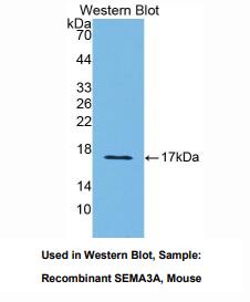 https://msimg.bioon.com/bionline/goods-no-pic.png