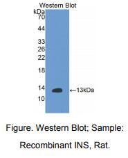 https://msimg.bioon.com/bionline/goods-no-pic.png