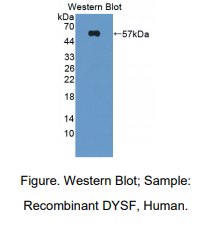 https://msimg.bioon.com/bionline/goods-no-pic.png