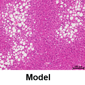 非酒精性脂肪肝模型