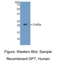 https://msimg.bioon.com/bionline/goods-no-pic.png