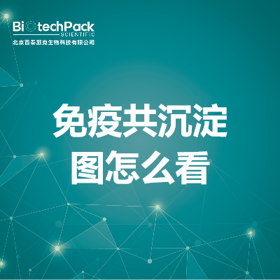 https://msimg.bioon.com/bionline/goods-no-pic.png