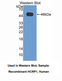 https://msimg.bioon.com/bionline/goods-no-pic.png