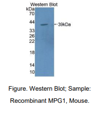 https://msimg.bioon.com/bionline/goods-no-pic.png