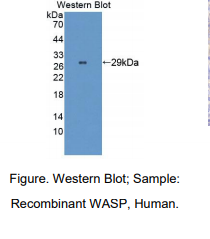 人免疫缺陷伴血小板减少综合征蛋白(WASP)多克隆抗体