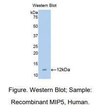 https://msimg.bioon.com/bionline/goods-no-pic.png