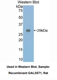 https://msimg.bioon.com/bionline/goods-no-pic.png