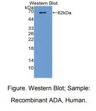 https://msimg.bioon.com/bionline/goods-no-pic.png