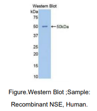 https://msimg.bioon.com/bionline/goods-no-pic.png