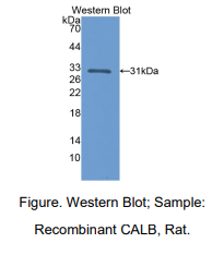 大鼠钙结合蛋白(CALB)多克隆抗体