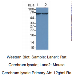 大鼠钙/钙调蛋白依赖性蛋白激酶Ⅱγ(CAMK2g)多克隆抗体