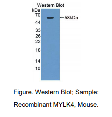 小鼠肌球蛋白轻链激酶4(MYLK4)多克隆抗体