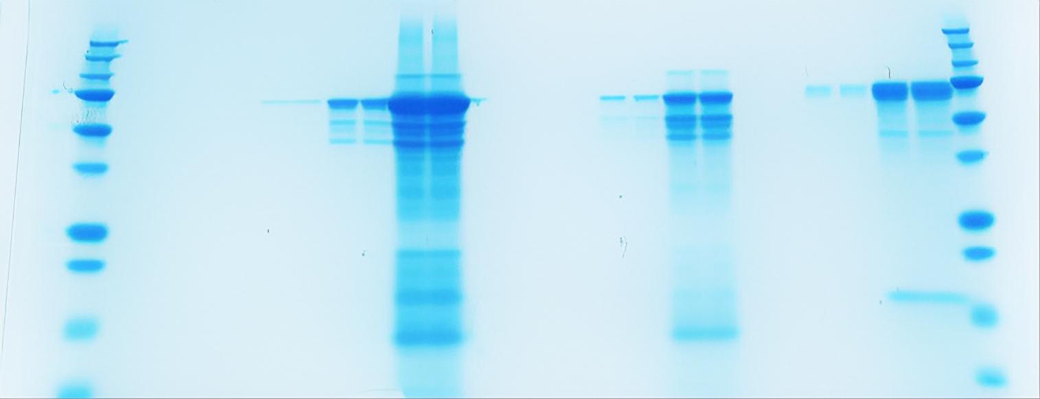 https://img.medsci.cn/09f7f9b396aaea8c5a2398de56f920980d508f8e7313325b130eae0a6c633bd4.png