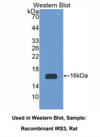 大鼠胰岛素受体底物3(IRS3)多克隆抗体