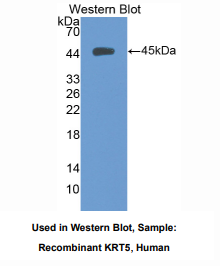 https://msimg.bioon.com/bionline/goods-no-pic.png