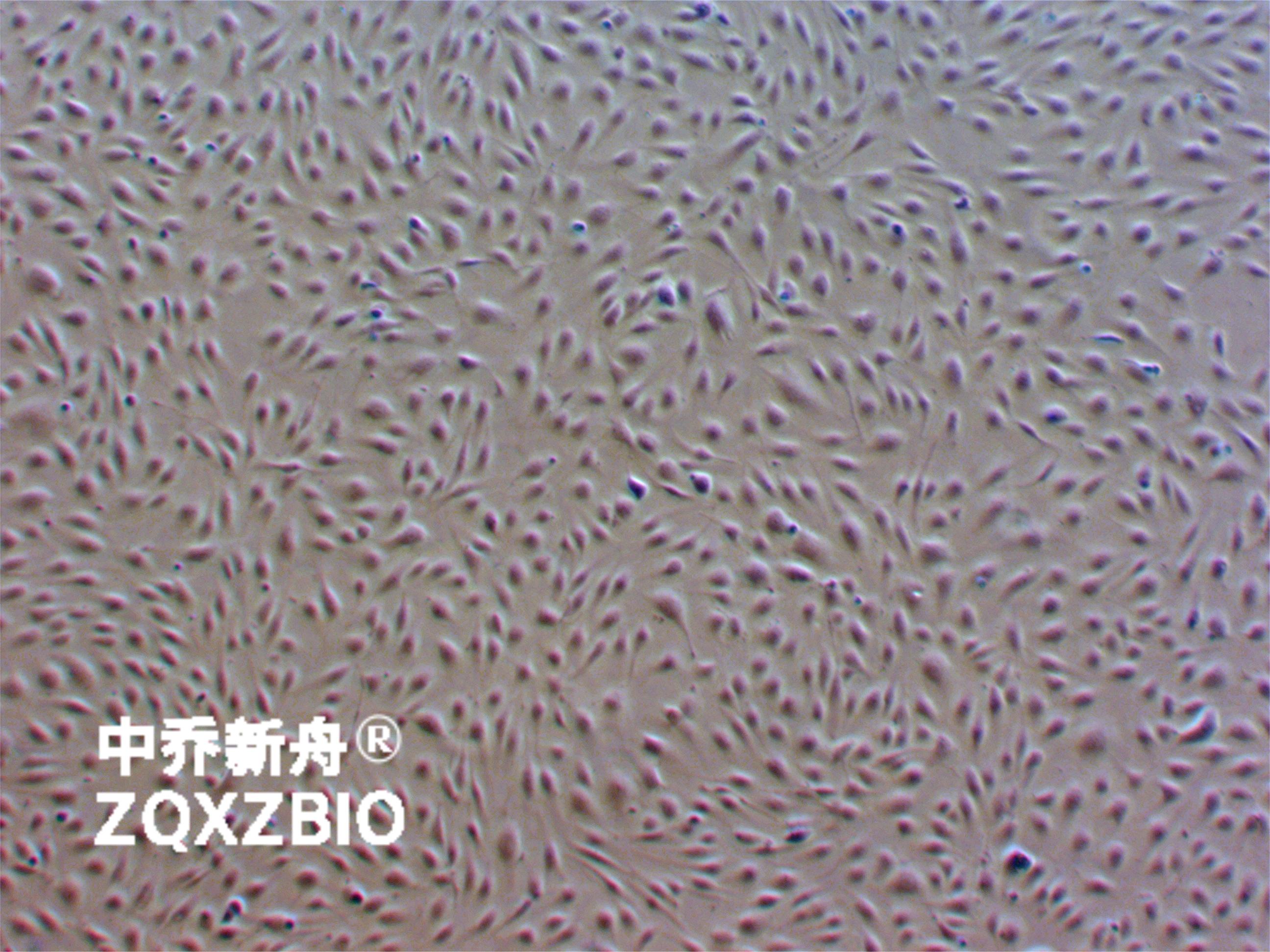 huvec-GFP原代人脐静脉内皮细胞-绿色标记