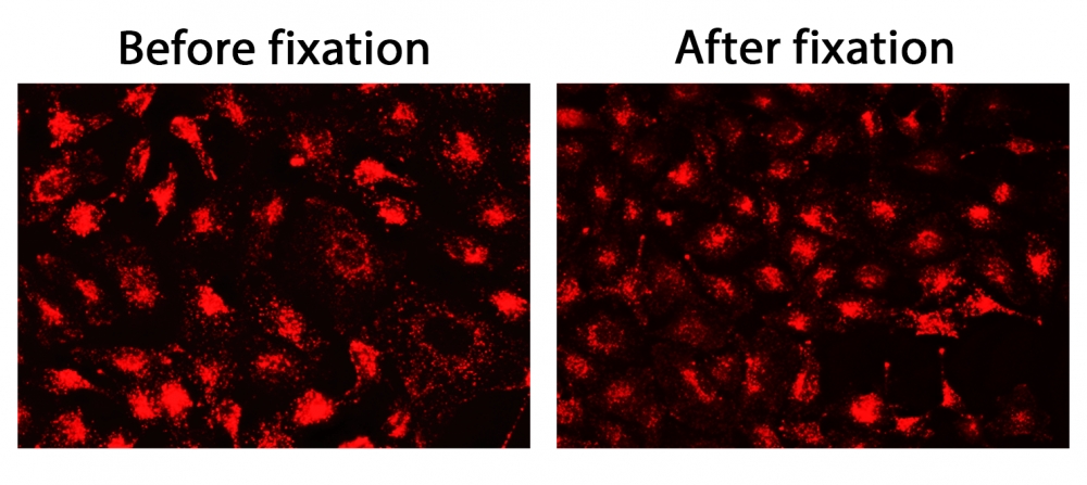 CytoFix 溶酶体红色探针