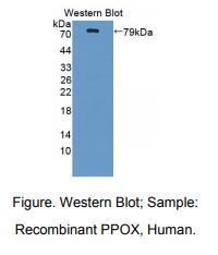 人原卟啉原氧化酶(PPOX)多克隆抗体
