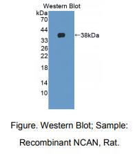 https://msimg.bioon.com/bionline/goods-no-pic.png