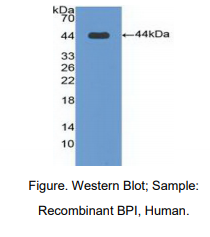 https://msimg.bioon.com/bionline/goods-no-pic.png