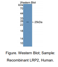 https://msimg.bioon.com/bionline/goods-no-pic.png