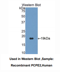 https://msimg.bioon.com/bionline/goods-no-pic.png