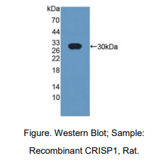 大鼠半胱氨酸丰富分泌蛋白1(CRISP1)多克隆抗体