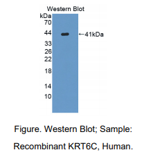 人角蛋白6C(KRT6C)多克隆抗体