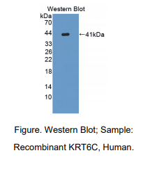 https://msimg.bioon.com/bionline/goods-no-pic.png