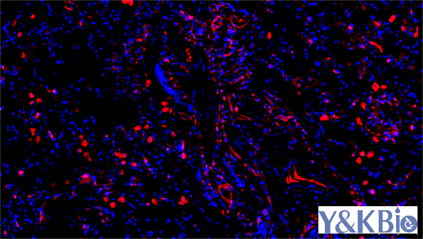 https://img.medsci.cn/09f7f9b396aaea8c5a2398de56f920980d508f8e7313325b130eae0a6c633bd4.png