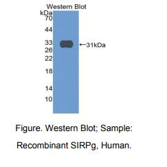 https://msimg.bioon.com/bionline/goods-no-pic.png