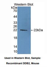 小鼠损伤特异性DNA结合蛋白2(DDB2)多克隆抗体