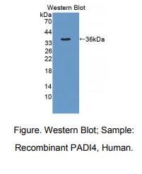 https://msimg.bioon.com/bionline/goods-no-pic.png