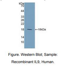 https://msimg.bioon.com/bionline/goods-no-pic.png