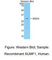 https://msimg.bioon.com/bionline/goods-no-pic.png