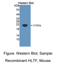 https://msimg.bioon.com/bionline/goods-no-pic.png