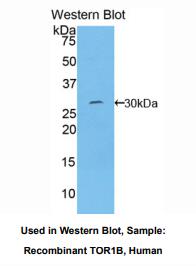 人耐扭蛋白1B(TOR1B)多克隆抗体