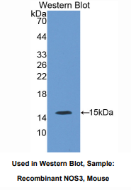 小鼠内皮型一氧化氮合酶(eNOS)多克隆抗体