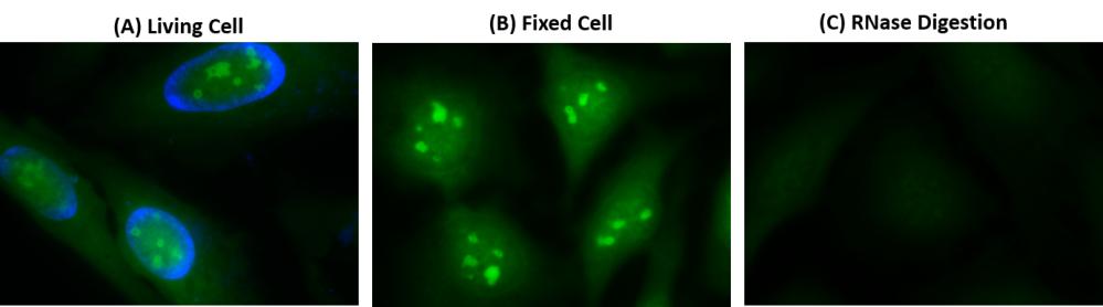 https://img.medsci.cn/e73eefcea40976357f460123cbf1e819c54e5106c9b457225be13b1cbc991aff.png