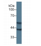 https://msimg.bioon.com/bionline/goods-no-pic.png