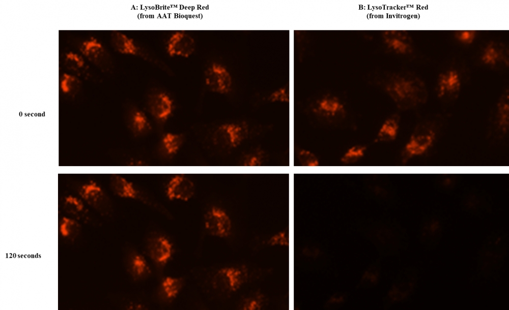 https://img.medsci.cn/e73eefcea40976357f460123cbf1e819c54e5106c9b457225be13b1cbc991aff.png