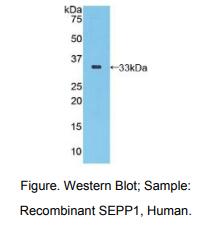 人硒蛋白P1(SEPP1)多克隆抗体