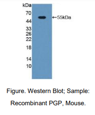 https://msimg.bioon.com/bionline/goods-no-pic.png