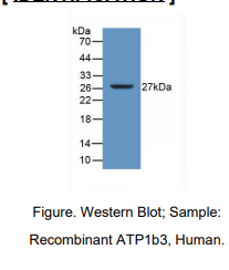 人钠/钾离子转运ATP酶β3肽(ATP1b3)多克隆抗体