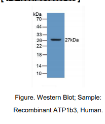 https://msimg.bioon.com/bionline/goods-no-pic.png