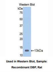 大鼠维生素D结合蛋白(DBP)多克隆抗体
