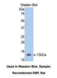 https://msimg.bioon.com/bionline/goods-no-pic.png