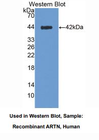 https://msimg.bioon.com/bionline/goods-no-pic.png