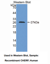 https://msimg.bioon.com/bionline/goods-no-pic.png